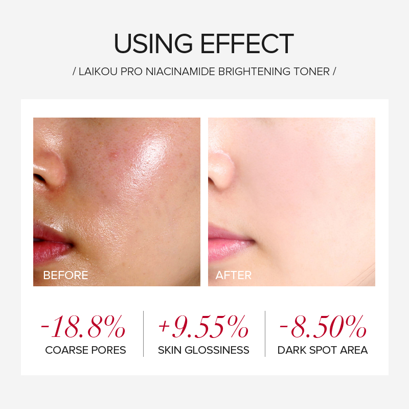 LAIKOU PRO Niacinamide 4-częśc – Niacinamide Brightening Serum recenzja i cena