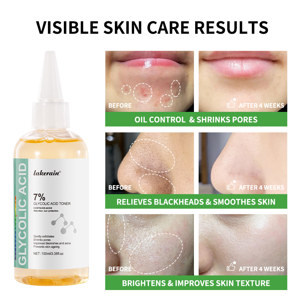 Kwas glikolowy 7% roztwór toni – Lactic Acid Toner recenzja i cena