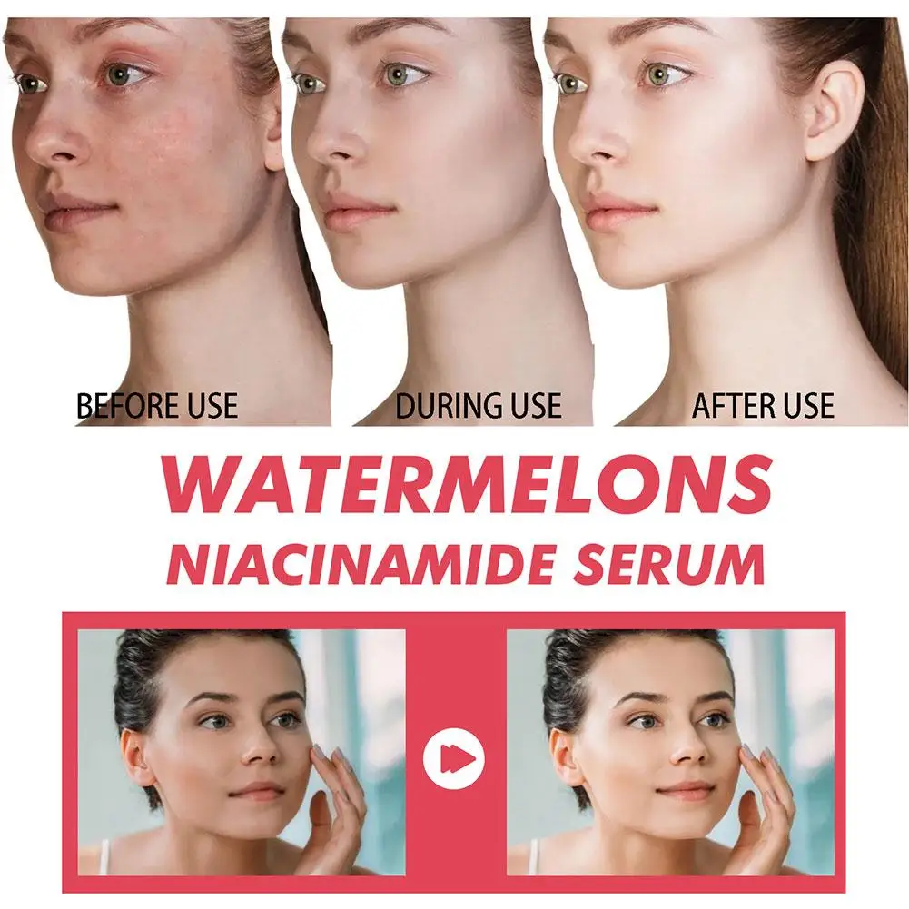 Arbuzowy blask niacynamid nawi – Niacinamide Brightening Serum recenzja i cena