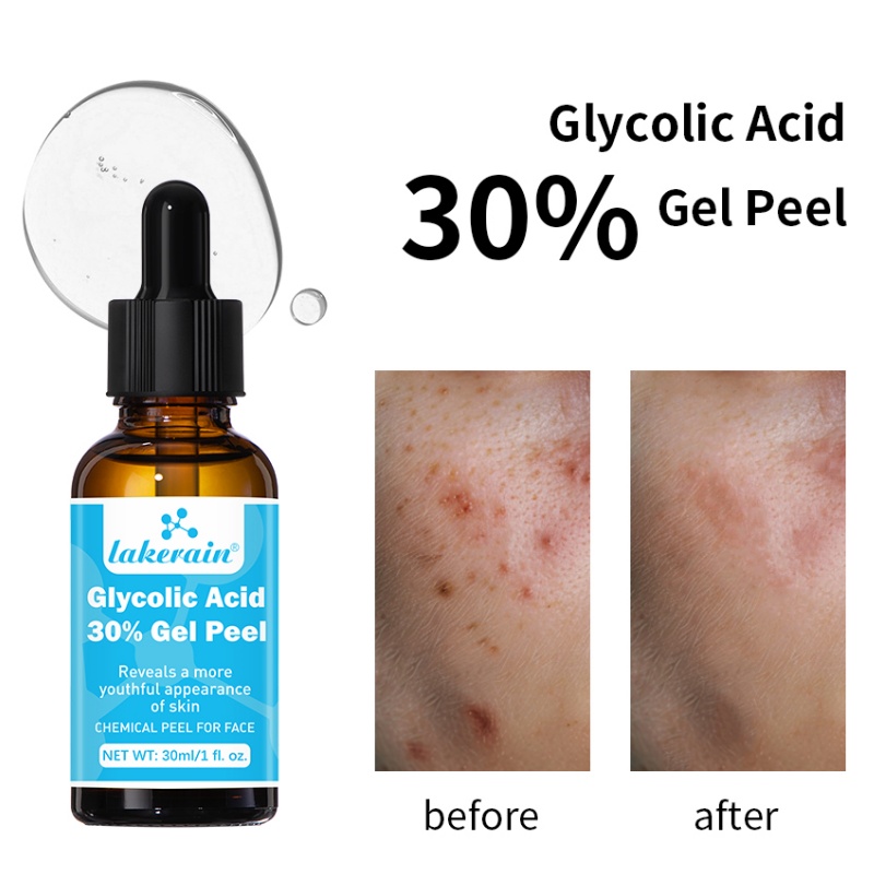 30% kwas glikolowy żel do peel – Lactic Acid Toner recenzja i cena