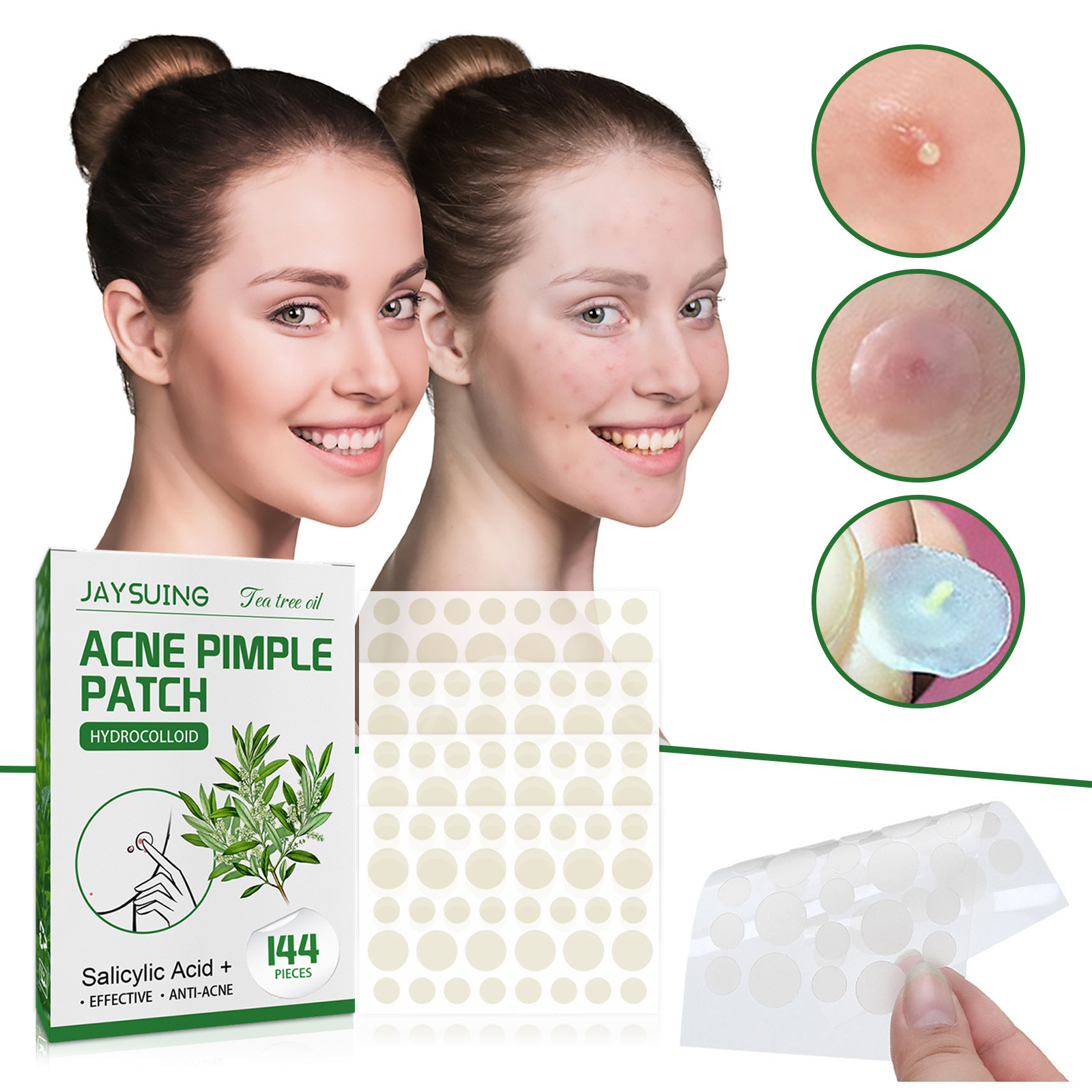 Plastry hydrokoloidowe na trąd – Skincare Moisturizer recenzja i cena